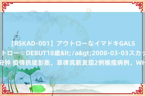 【RSKAD-001】アウトローなイマドキGALS 平成生まれ アウトロー☆DEBUT18歳</a>2008-03-03スカッド&$スカッド105分钟 疫情抓续彭胀，菲律宾新发现2例猴痘病例，WHO巨匠：全球大大皆东谈主无需接种疫苗，要紧的是改换步履